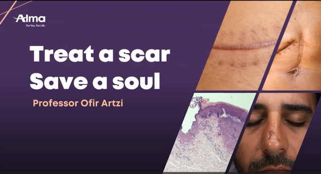 Gerenciamento de cicatrizes na era do Hybrid: uma abordagem combinada para o tratamento de cicatrizes