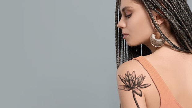 Como remover uma tatuagem: tudo o que você precisa saber